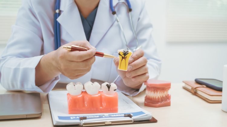 Cracked or Chipped Tooth
